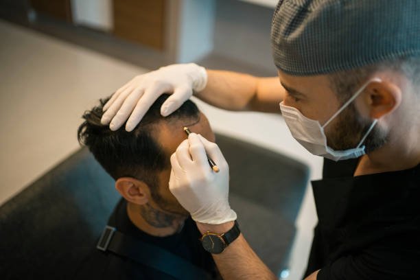 Hair Transplant in Dubai: Recovery Tips and Aftercare Guide